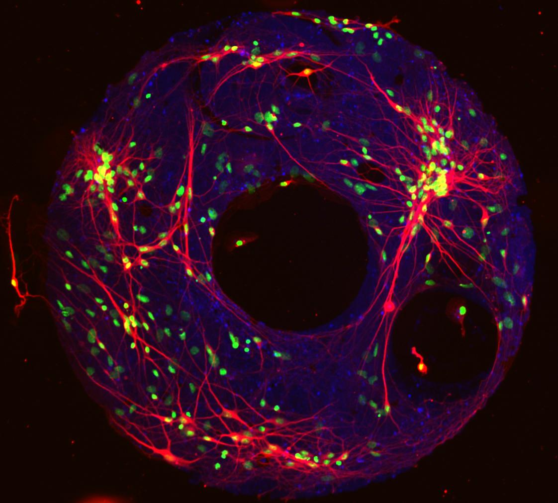 A fluorescent image of the neural network model developed at Pitt reveals the interconnection (red) between individual brain cells (blue). Adhesive proteins (green) allow the network to be constructed on silicon discs for experimentation.